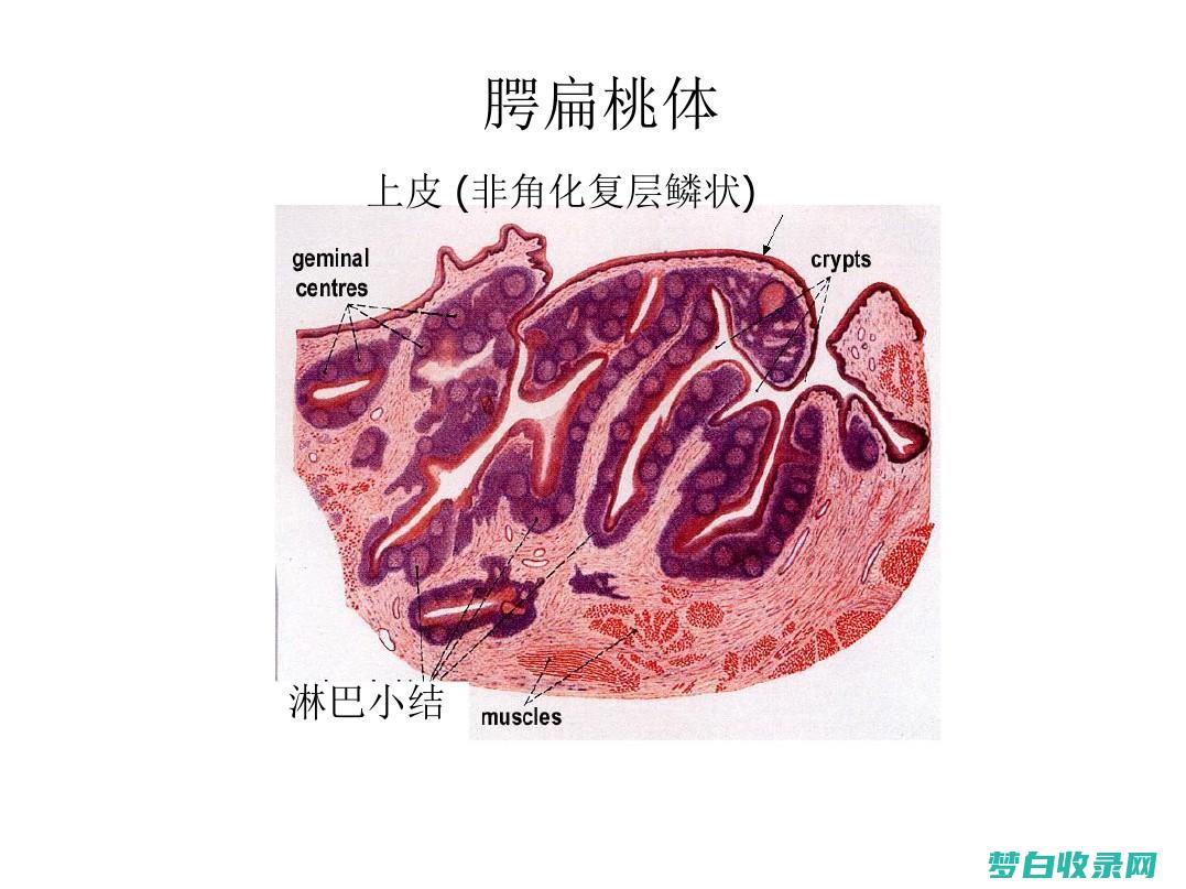 告别扁桃体发炎的折磨