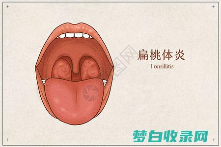 对抗扁桃体发炎：深入了解抗生素、止痛药和抗炎药 (对抗扁桃体发炎的药物)